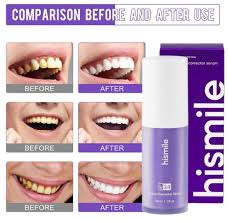 Hismile v34 Color Corrector Serum | HIGH QUALITY | Instant Teeth Brightening Solution | 30ml